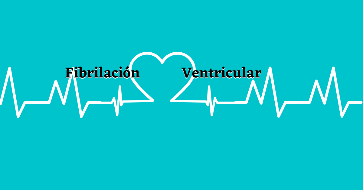 fibrilacion ventricular